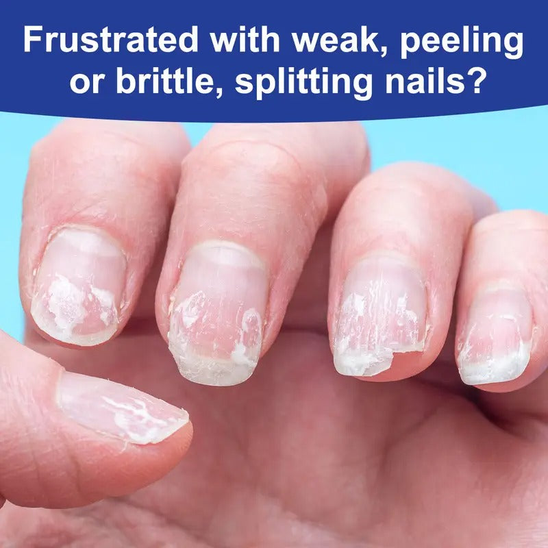 10ml/0.33fl.oz Formaldehyde-Free Nail Strengthener Oil with Vitamin E & Keratin - 7-Day Chip & Protection for Soft, Peeling Nails - Fast-Absorbing Nail Care Serum for Stronger, Healthier Nails