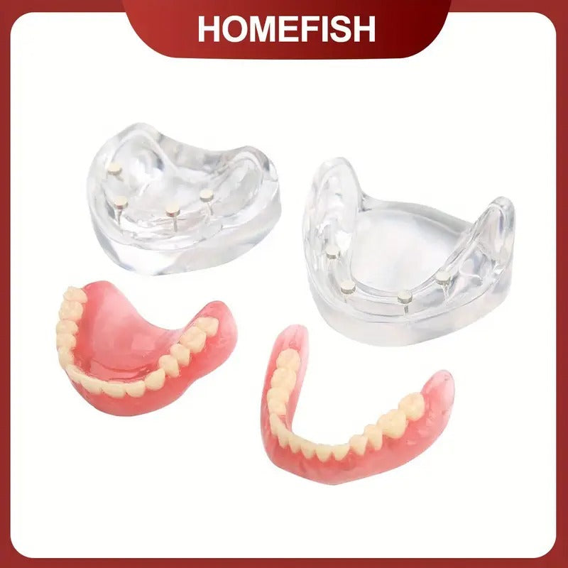 Dental Oral Teaching, Dental Upper/Lower Dentures with 4 Nails, Implant Dental Models, Detachable Doctor-Patient Communication Dental Models
