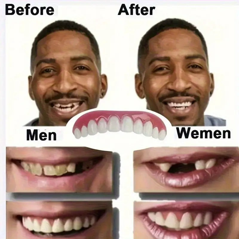 Adjustable Full Denture Set - Comfortable White Veneers for Upper & Lower Teeth, Durable Material, Easy to Use & Maintain, Ideal for Missing Teeth, Elderly, Banquet & Social Gatherings