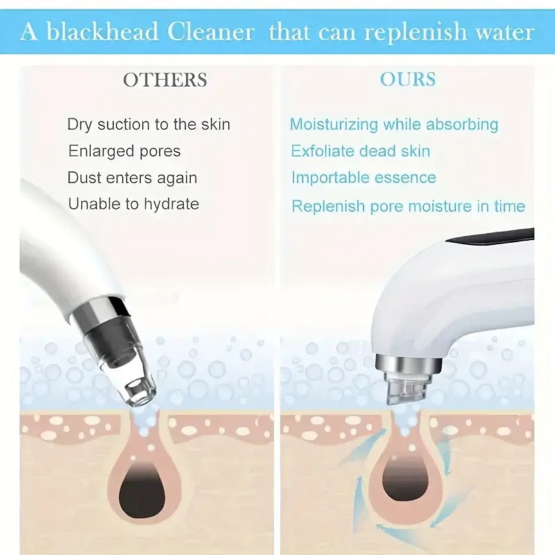 Blackhead Remover Vacuum Kit - Pore Cleaner Tool with 6 Attachments & 3 Suction Levels | USB Rechargeable, Portable for Travel, Visible Deep Cleansing for Men/Women
