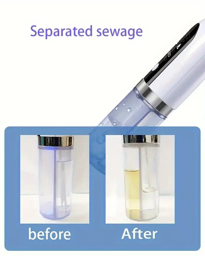 Blackhead Remover Vacuum Kit - Pore Cleaner Tool with 6 Attachments & 3 Suction Levels | USB Rechargeable, Portable for Travel, Visible Deep Cleansing for Men/Women