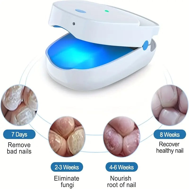 [Extra Strength KTS] KTS Nail Fungus Light Device | Extra Strength For Toenail, Fingernail With 407nm Blue Light & 905nm Light For Nail Fungus & Onychomycosis, At Home