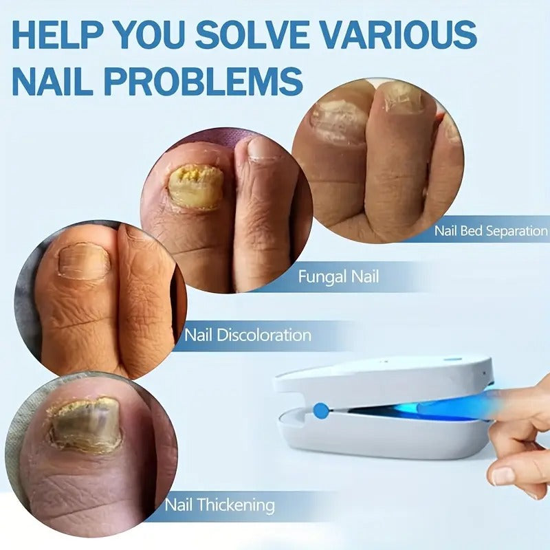 [Extra Strength KTS] KTS Nail Fungus Light Device | Extra Strength For Toenail, Fingernail With 407nm Blue Light & 905nm Light For Nail Fungus & Onychomycosis, At Home