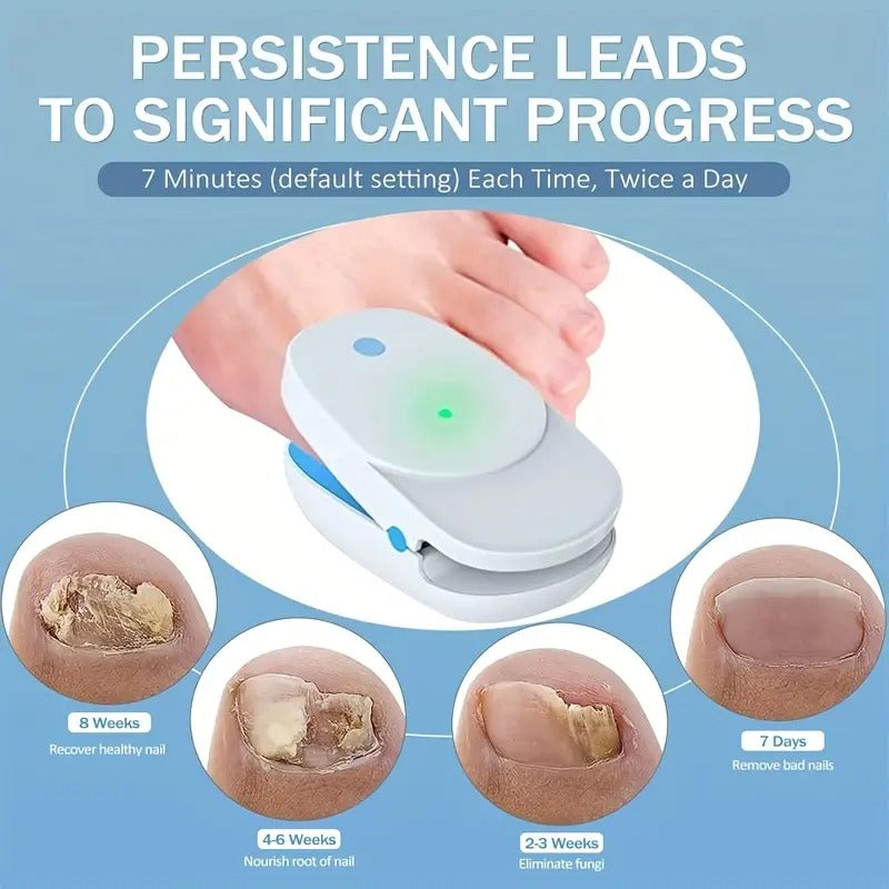 [Extra Strength KTS] KTS Nail Fungus Light Device | Extra Strength For Toenail, Fingernail With 407nm Blue Light & 905nm Light For Nail Fungus & Onychomycosis, At Home