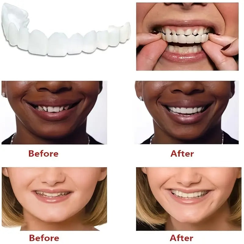 A Pack of 2-6 Disposable White Dental Trays That Are Easy to Clean, Suitable for Both Men And Women, Flexible, Adjustable, And Can Cover Missing Teeth, As Well As Stains from Smoking, Coffee, And Yellowing. They Are Convenient to Use.